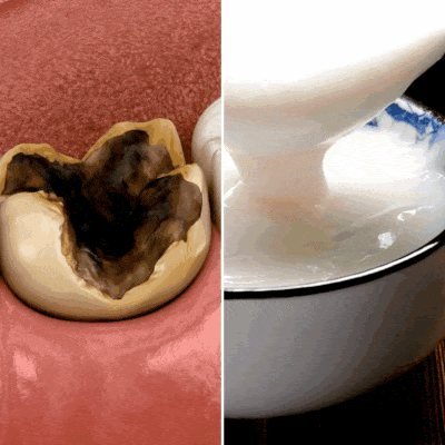 Odd Dental Hack Rebuilds Gums and Teeth Overnight