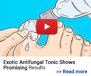 Read more about antifungal Tonic shows promising results 